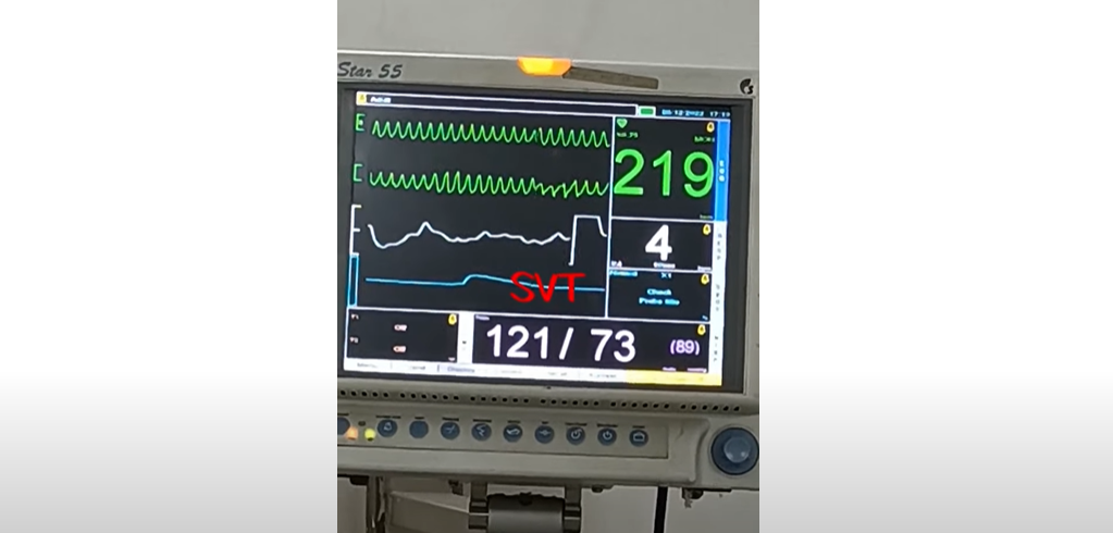 Can you die from tachycardia Can you die from tachycardia