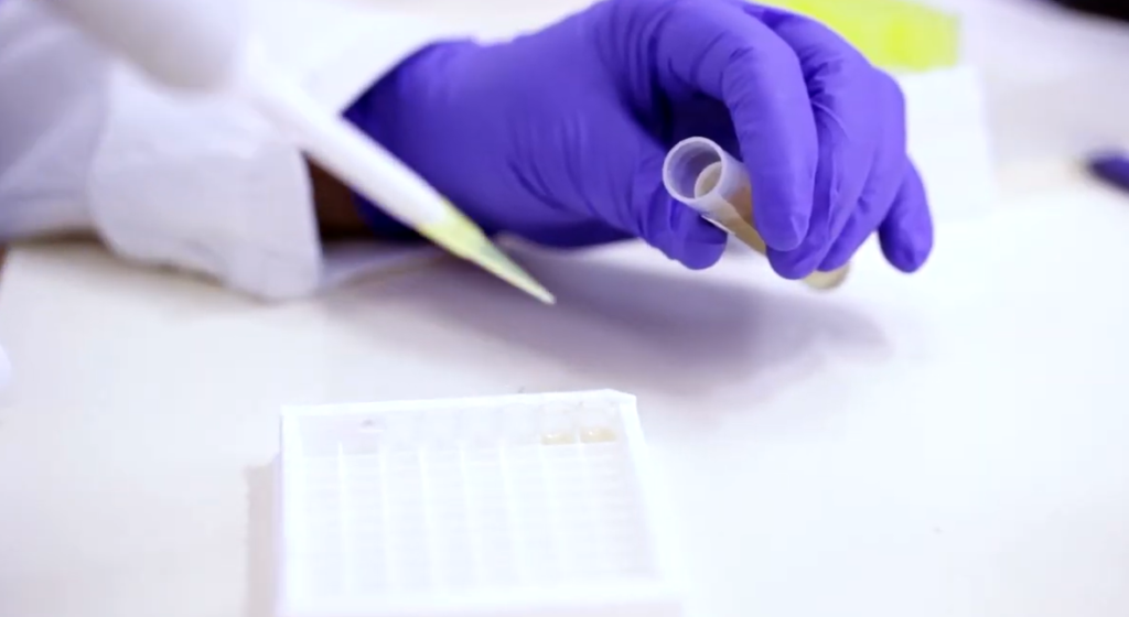 Sydney Legionnaires Disease Outbreak Grows as Fourth Case Confirmed