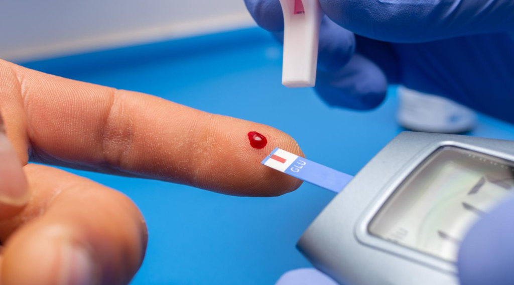 New Statins Cholesterol Guidelines Mean More Than Half of American Adults Could Be on Medication Soon