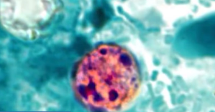 Deadly fungus outbreak